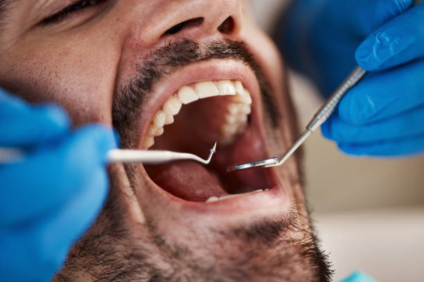 Best Emergency Broken Tooth Repair in New Haven, MO